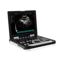 Échographe portable numérique de haute qualité pour usage hospitalier avec interface à double sonde - Échographe vétérinaire