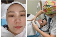 Appareil de rajeunissement de la peau du visage et d'épilation électrique à disque rotatif M22 avec 9 filtres pour usage domestique