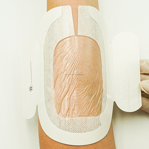 สติกเกอร์ยึดเข็มฉีดยาแบบใสขายดีที่สุด แผ่นปิดแผลแบบมีกาวสำหรับดูแลแผล แผ่นปิดแผลสำหรับยึดสายแคนนูลา ได้รับมาตรฐาน CE - Product Image 5