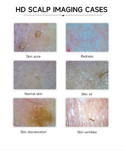 Analizador de cuero cabelludo de alta frecuencia Detector Máquina de prueba de piel portátil Máquina analizadora de piel facial - Product Image 6