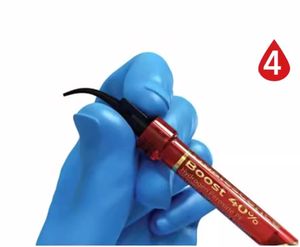 Kit <span class=keywords><strong>de</strong></span> Blanqueamiento Dental Ultradent 4751-1 4754-1 Opalescence Boost en <span class=keywords><strong>Consultorio</strong></span>, 40%, para un Solo Paciente - Product Image 6