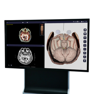 Tavolo di anatomia 3D <span class=keywords><strong>Anatomage</strong></span> virtuale umano tavolo di dissezione per autopsia virtuale del corpo umano digitale per la scuola - Product Image 6