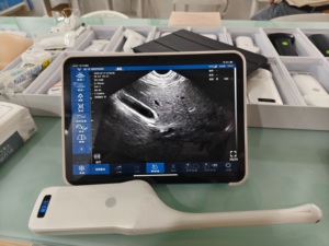 Dos Versiones de Sonda Endocavitaria Ginecológica Inalámbrica DMU92, Sonda de Ultrasonido Doppler Color para Diagnóstico Ginecológico Humano - Product Image 5