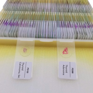 100個の人間の病気の病理学準備されたスライド準備された顕微鏡スライドを教える - Product Image 3