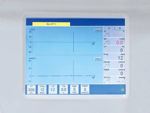 Mesin Anestesi Portabel Dokter Hewan dengan Mesin Anestesi Ventilator untuk Penggunaan Klinik Hewan - Product Image 3
