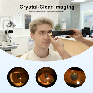 Ophthalmic <b>Optical</b> <b>Instruments</b> Portable Handheld Digital Slit Lamp S-150A with App With Mobile Adaptor - Product Image 4