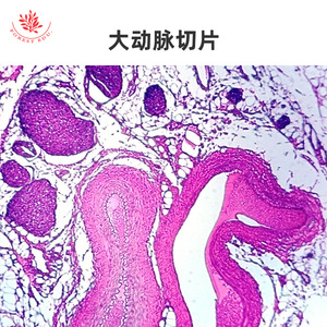 Microestructura típica de las pruebas de microscopio del sistema circulatorio, que incluyen venas grandes, arterias grandes y vasos renales después de la coloración HE. - Product Image 1