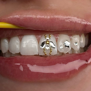 Gemas Dentales al por Mayor, Chapadas en Oro de 18K, Aleación con Cristales, Joyería Dental, Diseños de Mariposa, Corazón, Estrella, Mickey y Luna, Decoración DIY - Product Image 6