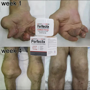 Crème articulaire Perfectx pour soulager les douleurs au genou, à la colonne vertébrale lombaire, aux jambes et au cou, crème de soin des articulations active pour la santé du corps, 30 g - Product Image 4