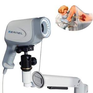 Factory Supply Ce Approved KN-2200A Video Colposcope <strong>Kernel</strong> Colposcop Digital Colposcope for Gynecology - Product Image 4
