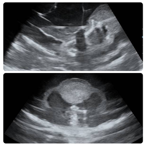 Modello Compatto per Addestramento ad Anatomia dell'Utero con Ultrasuoni, Simulatore Ginecologico con Ovario e Tromba di Fallope Inclusi - Product Image 4
