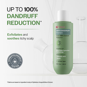 Lo <span class=keywords><strong>Shampoo</strong></span> <span class=keywords><strong>antiforfora</strong></span> R'ENDASE prende di mira il cuoio capelluto oleoso e getta i fiocchi secchi elimina i fiocchi di forfora allevia dall'olio in eccesso 750ml - Product Image 2