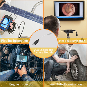 Mini endoscope médical dentaire, système d'imagerie USB, module de caméra orale avec compression vidéo H.264 pour une visualisation améliorée - Product Image 3