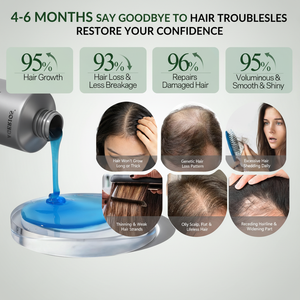 <span class=keywords><strong>Shampoo</strong></span> e Balsamo alla Caffeina per la <span class=keywords><strong>Crescita</strong></span> dei <span class=keywords><strong>Capelli</strong></span>, Anti-Caduta, Cura del Cuoio Capelluto, Ispessente e Rinforzante per Uomini e Donne - Product Image 3