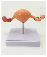 Modelo de Entrenamiento de Agrandamiento Patológico del Útero para Ciencias Médicas, Modelos de Útero para Facultad de Medicina