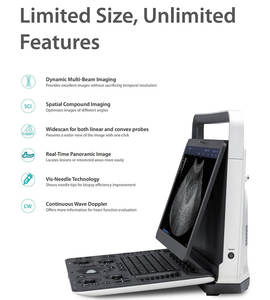 Portatil <span class=keywords><strong>Ultrasound</strong></span> Calcul automatique Système à ultrasons <span class=keywords><strong>Machine</strong></span> à ultrasons vétérinaire - Product Image 5