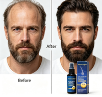Spray tonifiant capillaire à base de plantes OEM avec extrait de romarin, caféine et peptides, renforce les racines des cheveux, soin du cuir chevelu, brume pour hommes et femmes