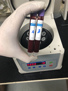Analysis Laboratory MKE TG16W 16500rpm 10*5ml High Speed Capillary Vessel Blood Hematocrit Testing Microcentrifuge - Product Image 4
