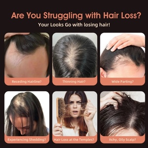 Peigne démêlant à picots pour cheveux longs, machine de repousse capillaire, applicateur EMS pour le cuir chevelu et médicaments capillaires - Product Image 3