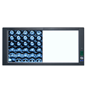 เครื่องดูฟิล์มทางการแพทย์ LED สองชั้นแบบบางพิเศษควบคุมด้วยระบบดิจิทัลเต็มรูปแบบ