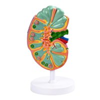 Modèle anatomique d'organe rénal agrandi avec ganglions lymphatiques - Outil de démonstration pédagogique du système lymphatique pour l'enseignement médical