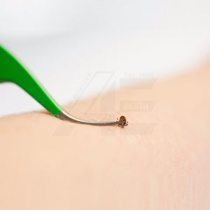 Kit Premium para Eliminar Garrapatas 2026 - Juego de Dos Extractores de Garrapatas de Acero para Gatos y Perros, Kit de Primeros Auxilios con Estuche de Cuero, ODM OEM - Product Image 4