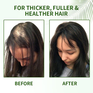 Saç beslenme ve büyüme için yüksek kaliteli organik konsantre Batana saç yağı OEM/ODM organik esansiyel yağ toptan - Product Image 3