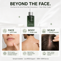 Sérum à l'acide azélaïque 10% en marque propre avec extraits de Centella et vitamine E, traitement anti-acné réducteur de pores