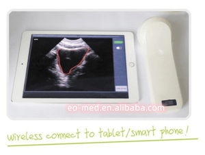 Scanner de vessie à ultrasons sans fil à haute vitesse (2s), mini scanner portatif 4d B10 - Product Image 4