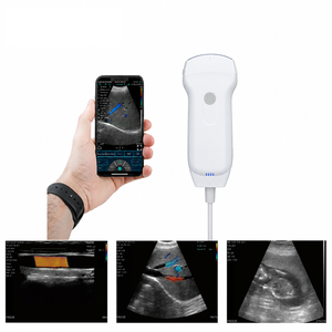 Sonde d'échographie <span class=keywords><strong>Doppler</strong></span> couleur sans fil <span class=keywords><strong>de</strong></span> <span class=keywords><strong>poche</strong></span>, scanner vétérinaire portable Wi-Fi pour hôpital vétérinaire et ferme - Product Image 3