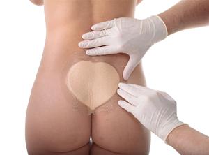 Perawatan luka canggih Sacrum pembalut luka meningkatkan kenyamanan bedah bantalan busa silikon 18x18cm bersertifikat CE - Product Image 6