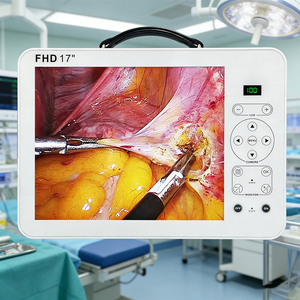 Système d'endoscopie portable Full HD 17 pouces avec caméra pour laparoscopie à vendre – Fournisseur de systèmes d'endoscopie médicale compacte - Product Image 1