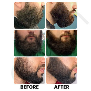 Olio per Barba Luxfume per <span class=keywords><strong>Uomo</strong></span>, Formula Idratante Cruelty Free, Rinfrescante e Anti-Prurito per una Crescita Sana - Product Image 3