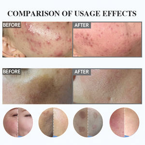 Exfoliante Facial Coreano Herbal 99% Spongilla, Exfoliante Facial <span class=keywords><strong>Orgánico</strong></span> para el Cuidado <span class=keywords><strong>de</strong></span> la Piel, Suero Exfoliante <span class=keywords><strong>de</strong></span> <span class=keywords><strong>Algas</strong></span> Orgánicas Spircules - Product Image 5