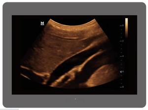 Siêu âm DP10 usg trắng và đen siêu âm cụ Chẩn đoán với chức năng PW - Product Image 5