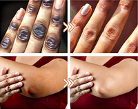 Sérum éclaircissant pour les jointures sombres en 7 jours, réduit la pigmentation, huile exfoliante jaune pour éclaircir et unifier le teint des peaux foncées