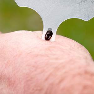 Enlève les tiques compactes en plastique de la taille d'une carte de crédit avec loupe Caractéristique écologique Enveloppe imprimée avec logo personnalisable - Product Image 4