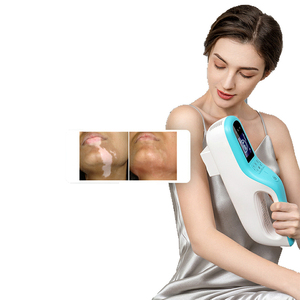 Advanced 308nm Excimer Light Vitiligo Treatment <b>Machine</b> for Targeted Skin Therapy Repigmentation Melanin Activation Skin Recover - Product Image 4