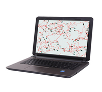 Analyseur de sperme de Microscope biologique Machine Analyseur de sperme de logiciel automatique médical clinique pour humain et vétérinaire