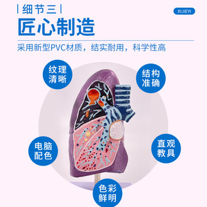 Modelo de pulmón humano, modelo de anatomía patológica del pulmón, sistema respiratorio, modelo de órgano humano, modelo de pulmón enfermo - Product Image 5