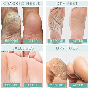 Private Label Feet <b>Moisturizing</b> Foot Mask Peel Exfoliating Foot Treatment <b>Socks</b> for Women - Product Image 2