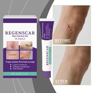 Crema para Eliminar Cicatrices, Hiperplasia, Quemaduras, Lesiones por Escaldaduras, Cicatrices Quirúrgicas, Estrías, Eliminador de Cicatrices y Marcas - Product Image 3