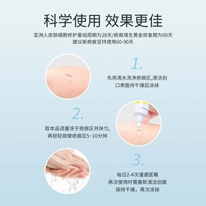 Gel cicatrisant médical en silicone Compvo 15g pour les cicatrices chirurgicales, de césarienne et de brûlures - Product Image 2