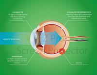 Benutzer definierte Größe Panel gehärtetes Glas 3D-Weichheit entlastet Computer Eye Strain 32-Zoll-Anti-Blaulicht-TV-Displayschutz