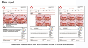 Mesin <span class=keywords><strong>ultrasound</strong></span> peralatan elektronik Kernel optik colposkop untuk ujian prostat KN 2200 - Product Image 3