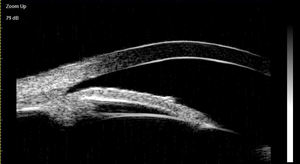 Ecógrafo Oftálmico, Ultrasonido <span class=keywords><strong>Ocular</strong></span>, Biomicroscopio de Ultrasonido Oftálmico para Oftalmología - Product Image 6