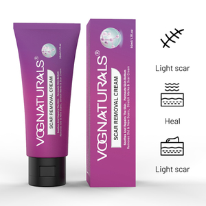 Crème Réparatrice Nourrissante OEM ODM pour l'Élimination des Cicatrices, Atténuation des Marques d'Acné et des Vergetures pour Hommes et Femmes – Soin de la Peau - Product Image 3