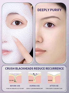 Burbuja de oxígeno carbonatada, espuma de limpieza hidratante profunda coreana, limpiador Facial Inno, máscara de Gel de eliminación de espinillas purificante facial - Product Image 3