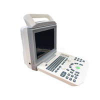 SYA-150_VET Portable Pregnancy Veterinary Color Ultrasound Machine & Used for Clinical Ultrasound Examination Zoncare I50