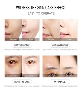 เครื่องสปาใบหน้าด้วยออกซิเจนเจ็ทสำหรับผิวกระชับหน้าออโร4อิน1เครื่องกำจัดริ้วรอยอเนกประสงค์ - Product Image 5